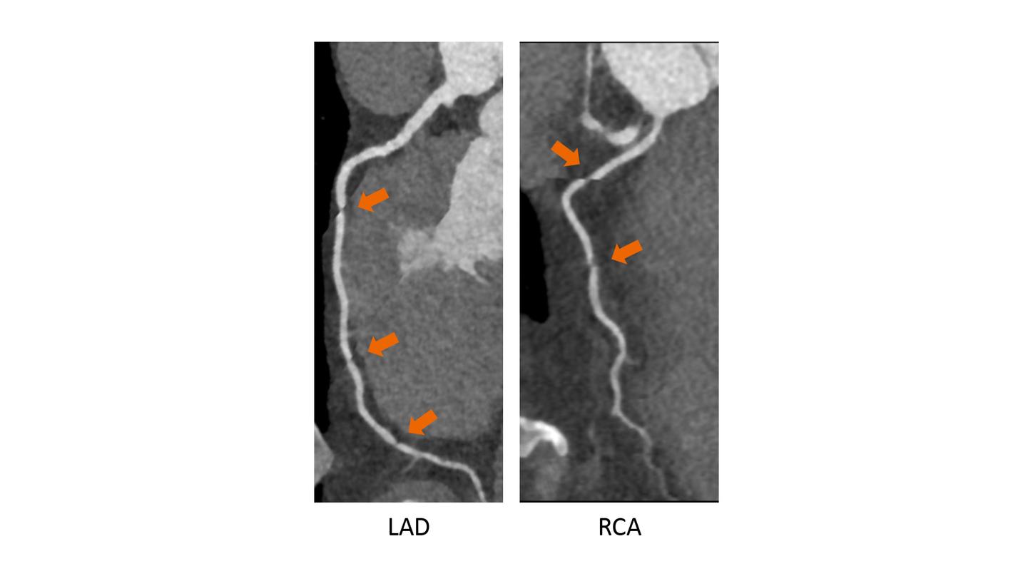 ZeeFree Cardiac Imaging